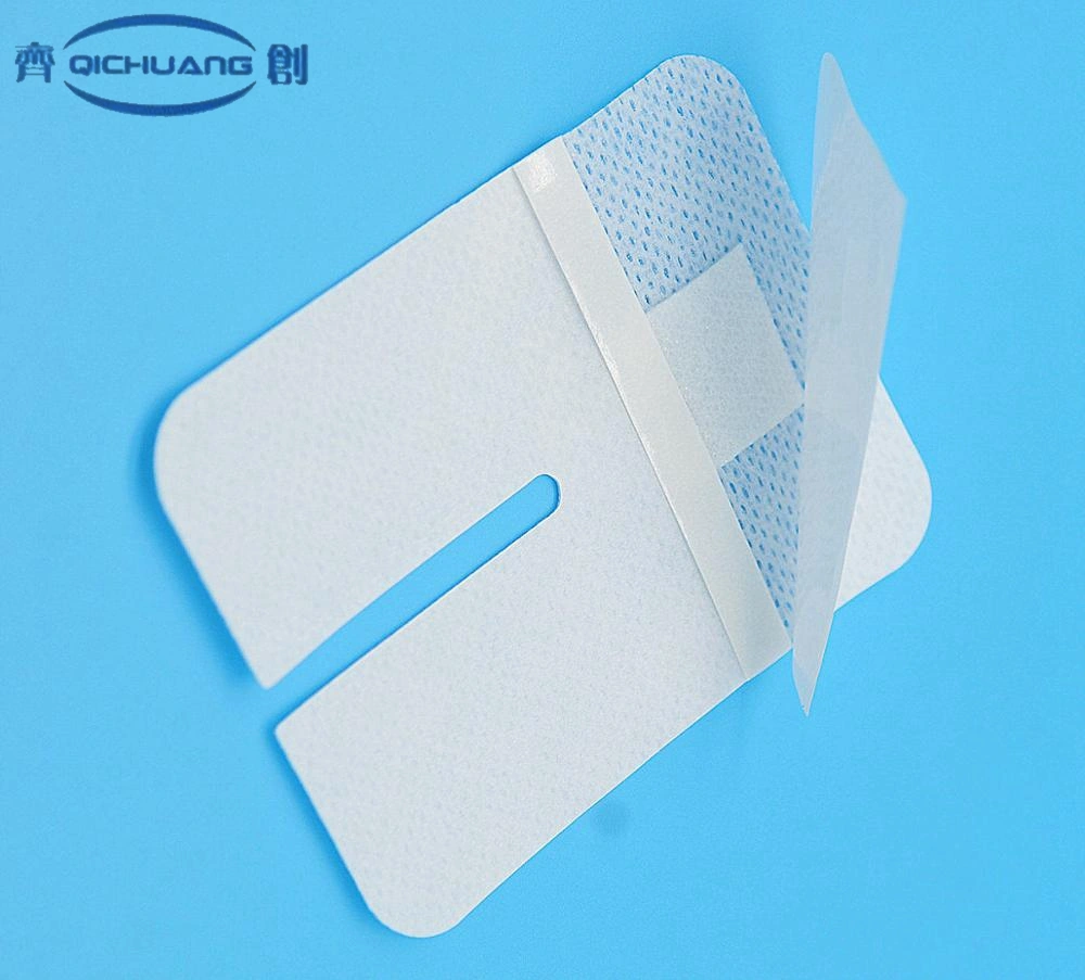 Qichuang Sterile IV Catheter Fixation Disposable Surgical Wound Care IV Wound Dressing Pad