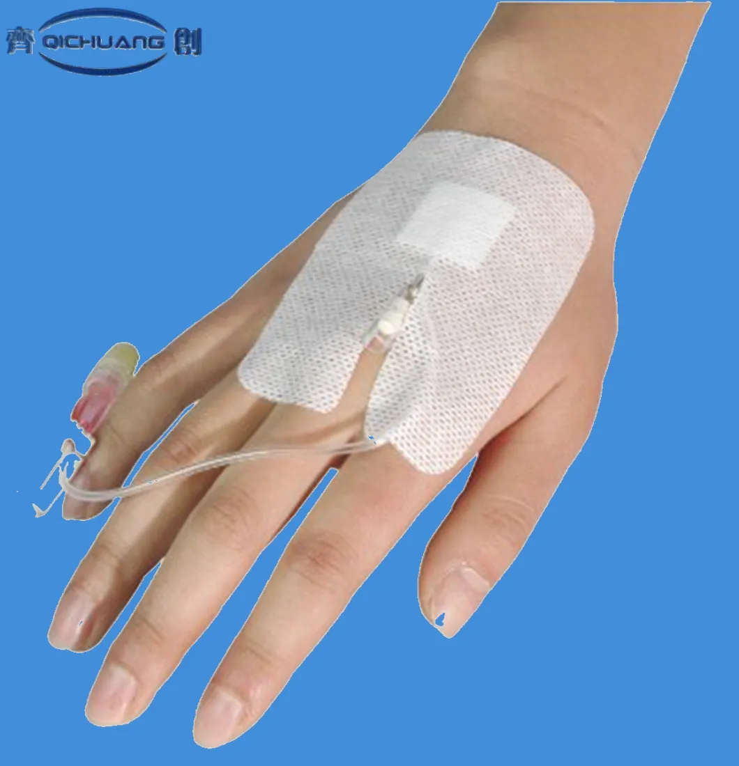 Qichuang Sterile IV Catheter Fixation Disposable Surgical Wound Care IV Wound Dressing Pad