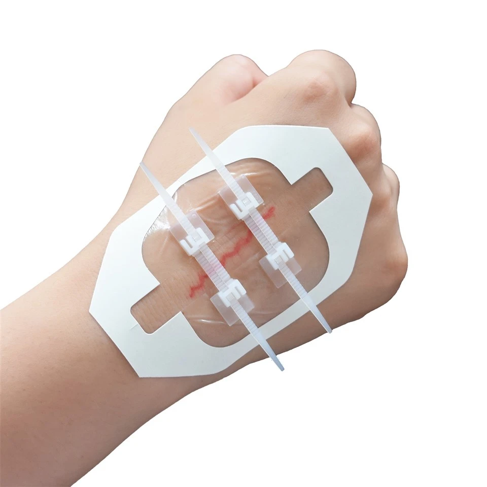 Zip Stitch Sutures Wound Closure Device Skin Closure Strips suppliers
