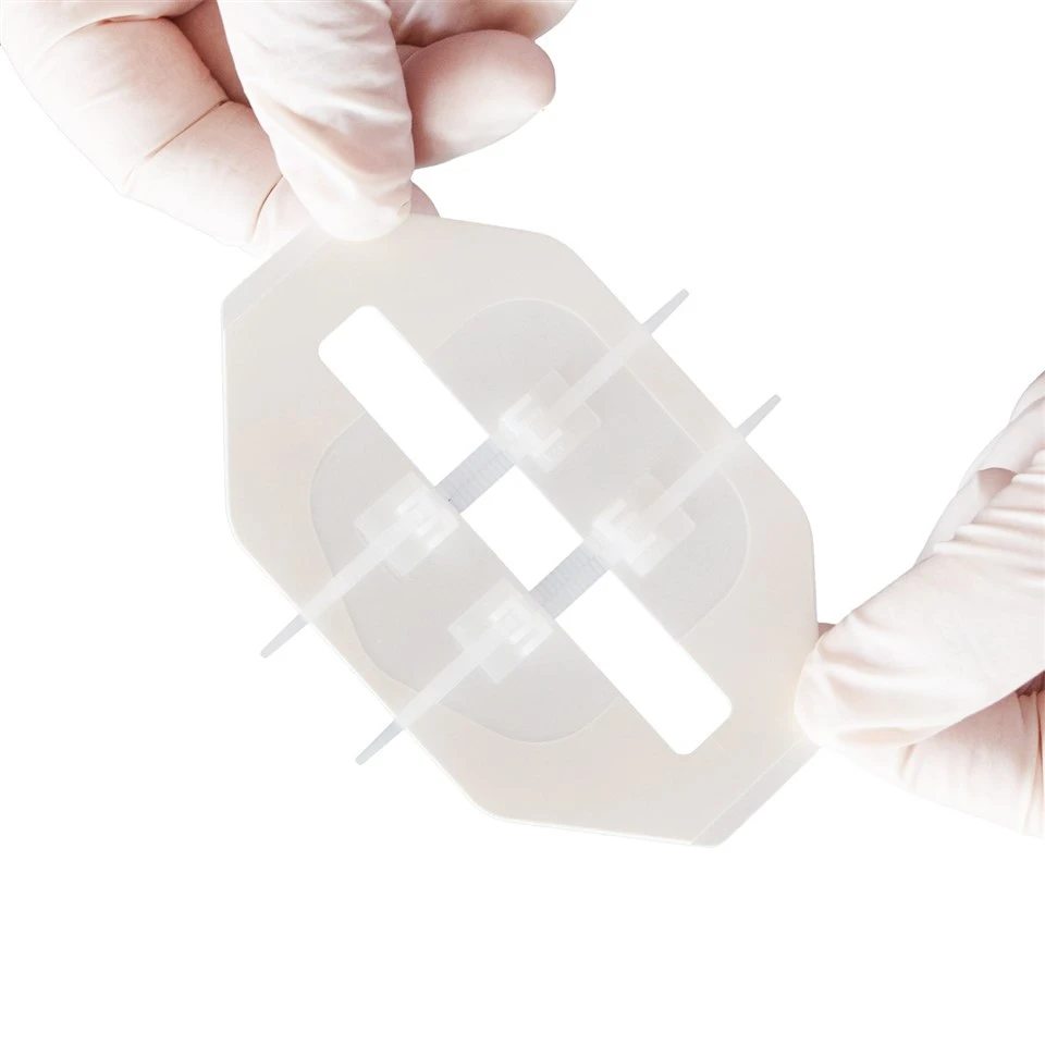 Zip Stitch Sutures Wound Closure Device Skin Closure Strips best