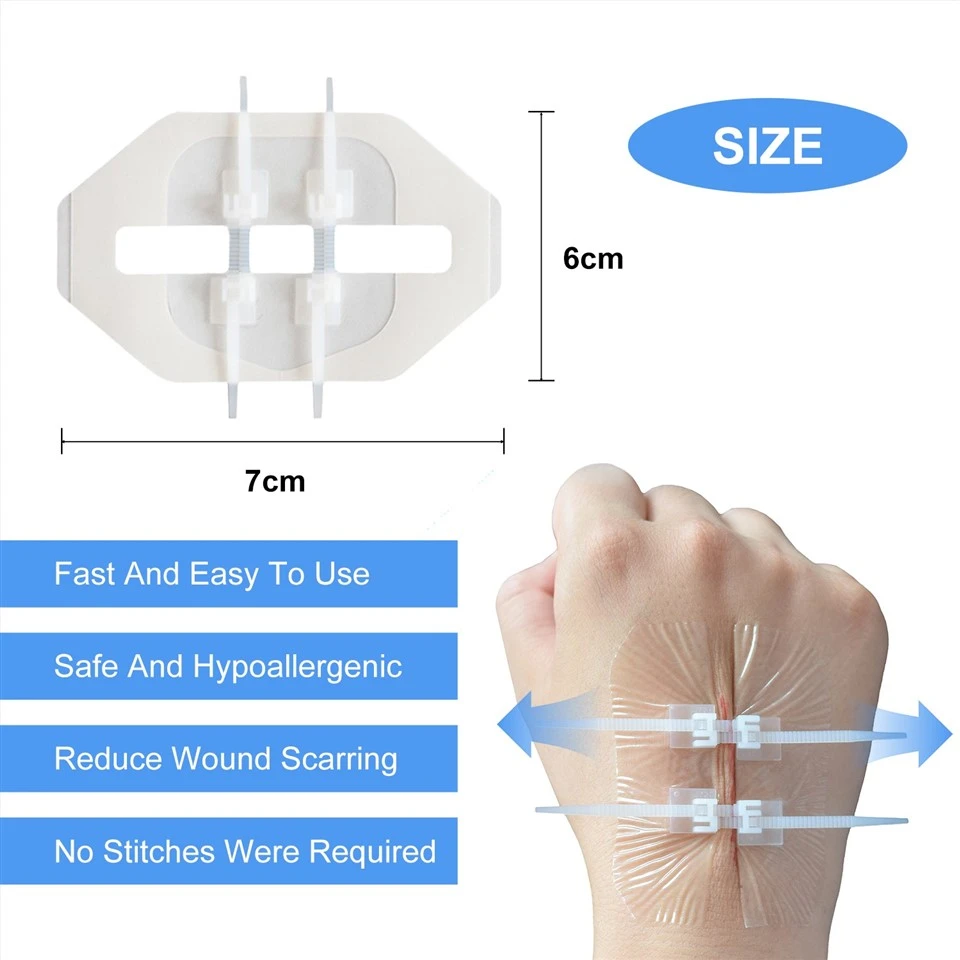 Zip Stitch Sutures Wound Closure Device Skin Closure Strips high quality